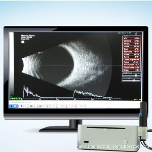 High Quality Ultrasound Ab Scan for Ophthalmology